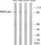 Calcium-independent phospholipase A2-gamma antibody, abx014289, Abbexa, Western Blot image 