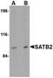 SATB Homeobox 2 antibody, orb75000, Biorbyt, Western Blot image 