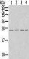 Ubiquitin Domain Containing 1 antibody, TA351885, Origene, Western Blot image 