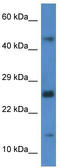 GATE-16 antibody, TA340175, Origene, Western Blot image 