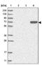 Family With Sequence Similarity 217 Member A antibody, NBP1-93471, Novus Biologicals, Western Blot image 