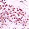 c-Myc antibody, LS-C352578, Lifespan Biosciences, Immunohistochemistry paraffin image 