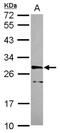 Cyclin-dependent kinase 10 antibody, NBP2-14908, Novus Biologicals, Western Blot image 