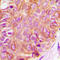 Raf-1 Proto-Oncogene, Serine/Threonine Kinase antibody, LS-C368521, Lifespan Biosciences, Immunohistochemistry paraffin image 