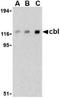 Cbl Proto-Oncogene antibody, TA306364, Origene, Western Blot image 