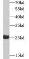 Adenylate kinase isoenzyme 4, mitochondrial antibody, FNab00247, FineTest, Western Blot image 