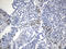 Opa Interacting Protein 5 antibody, LS-C795545, Lifespan Biosciences, Immunohistochemistry paraffin image 