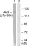 ABL Proto-Oncogene 1, Non-Receptor Tyrosine Kinase antibody, LS-C198581, Lifespan Biosciences, Western Blot image 