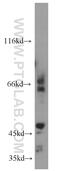 Matrix Metallopeptidase 14 antibody, 14552-1-AP, Proteintech Group, Western Blot image 