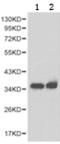 Stp antibody, TA323278, Origene, Western Blot image 