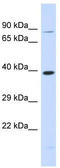 Rhomboid Like 2 antibody, TA342039, Origene, Western Blot image 