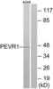 GPR172A antibody, LS-C120938, Lifespan Biosciences, Western Blot image 