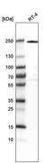 von Willebrand factor A domain-containing protein 8 isoform b precursor  antibody, PA5-58648, Invitrogen Antibodies, Western Blot image 