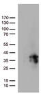 O-6-Methylguanine-DNA Methyltransferase antibody, TA809132, Origene, Western Blot image 