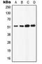 ATPase H+ Transporting Accessory Protein 1 antibody, orb213594, Biorbyt, Western Blot image 