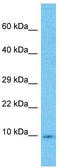 High Mobility Group Nucleosomal Binding Domain 3 antibody, TA339226, Origene, Western Blot image 