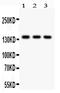 Period Circadian Regulator 1 antibody, PA2044, Boster Biological Technology, Western Blot image 