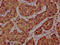 Protein phosphatase Slingshot homolog 1 antibody, LS-C681465, Lifespan Biosciences, Immunohistochemistry paraffin image 