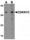 Cyclin Dependent Kinase Inhibitor 1C antibody, TA319629, Origene, Western Blot image 