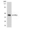 Arginine Vasopressin Receptor 2 antibody, LS-C200167, Lifespan Biosciences, Western Blot image 