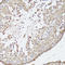 MSL-1 antibody, LS-C749050, Lifespan Biosciences, Immunohistochemistry paraffin image 