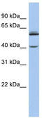 Cytochrome P450 Family 4 Subfamily V Member 2 antibody, TA335104, Origene, Western Blot image 