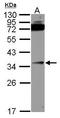 TNF Receptor Superfamily Member 6b antibody, GTX114130, GeneTex, Western Blot image 