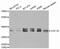 Eukaryotic Translation Elongation Factor 1 Delta antibody, PA5-76656, Invitrogen Antibodies, Western Blot image 