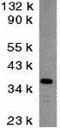 DNA Fragmentation Factor Subunit Beta antibody, GTX31257, GeneTex, Western Blot image 