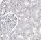 DEAD-Box Helicase 54 antibody, NBP1-89028, Novus Biologicals, Immunohistochemistry paraffin image 