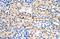 Sulfatase 2 antibody, ARP49338_T100, Aviva Systems Biology, Immunohistochemistry paraffin image 