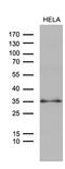Zinc Finger Matrin-Type 4 antibody, M17345, Boster Biological Technology, Western Blot image 
