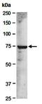 Histone acetyltransferase MYST2 antibody, orb67070, Biorbyt, Western Blot image 