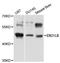 Endoplasmic Reticulum Oxidoreductase 1 Beta antibody, STJ26443, St John
