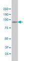 Mitogen-Activated Protein Kinase Kinase Kinase Kinase 5 antibody, H00011183-M01, Novus Biologicals, Western Blot image 