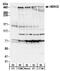 E3 ubiquitin-protein ligase HERC2 antibody, NBP1-05970, Novus Biologicals, Western Blot image 