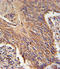 Retinol Dehydrogenase 10 antibody, LS-C162521, Lifespan Biosciences, Immunohistochemistry paraffin image 