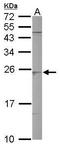 Secretion Associated Ras Related GTPase 1B antibody, GTX109170, GeneTex, Western Blot image 
