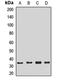 Endonuclease III-like protein 1 antibody, LS-C668101, Lifespan Biosciences, Western Blot image 