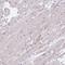Calcium Voltage-Gated Channel Subunit Alpha1 S antibody, HPA048892, Atlas Antibodies, Immunohistochemistry paraffin image 