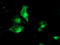 Tubulin Folding Cofactor C antibody, TA504735, Origene, Immunofluorescence image 
