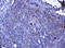 Ras Homolog Family Member J antibody, LS-C174421, Lifespan Biosciences, Immunohistochemistry paraffin image 