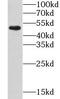 Carbohydrate Sulfotransferase 1 antibody, FNab01689, FineTest, Western Blot image 