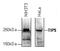 Bromodomain adjacent to zinc finger domain protein 2A antibody, TA347082, Origene, Western Blot image 
