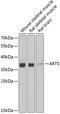 ADP-Ribosyltransferase 5 antibody, GTX65955, GeneTex, Western Blot image 