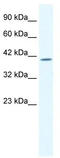 ETS Transcription Factor ELK4 antibody, TA335855, Origene, Western Blot image 