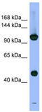 Proteasome 26S Subunit, Non-ATPase 1 antibody, TA342173, Origene, Western Blot image 