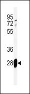 Adrenomedullin antibody, LS-C156099, Lifespan Biosciences, Western Blot image 