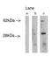 LAG1 longevity assurance homolog 4 antibody, PA1-12928, Invitrogen Antibodies, Western Blot image 