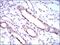 Ribosomal Protein L18a antibody, NBP2-37396, Novus Biologicals, Immunohistochemistry paraffin image 